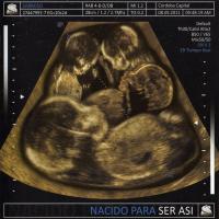 Canción 'Guerra fría' del disco 'Nacido Para Ser Asi' interpretada por Sabroso Canción 'Guerra fría' del disco 'Nacido Para Ser Asi' interpretada por Sabroso