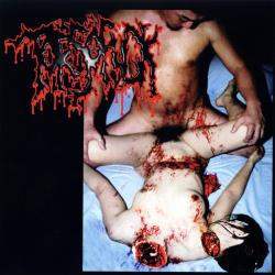 Fistfucking Her Decomposed Cadaver del álbum 'Disgusting Gore and Pathology / Polymorphisms to Severe Sepsis in Trauma'