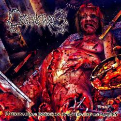 Sanguinary Misogynistic Execration del álbum 'Uterovaginal Insertion of Extirpated Anomalies'