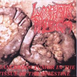 Inflammatory Fermentation Of The Gastric Tissue del álbum 'Malignant Cancerous Tumor in the Epitelial Tissue of the Intestine'