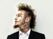 Stitches