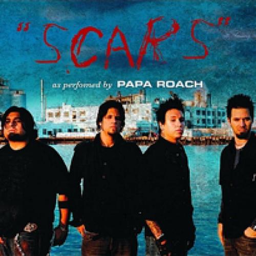 Scars